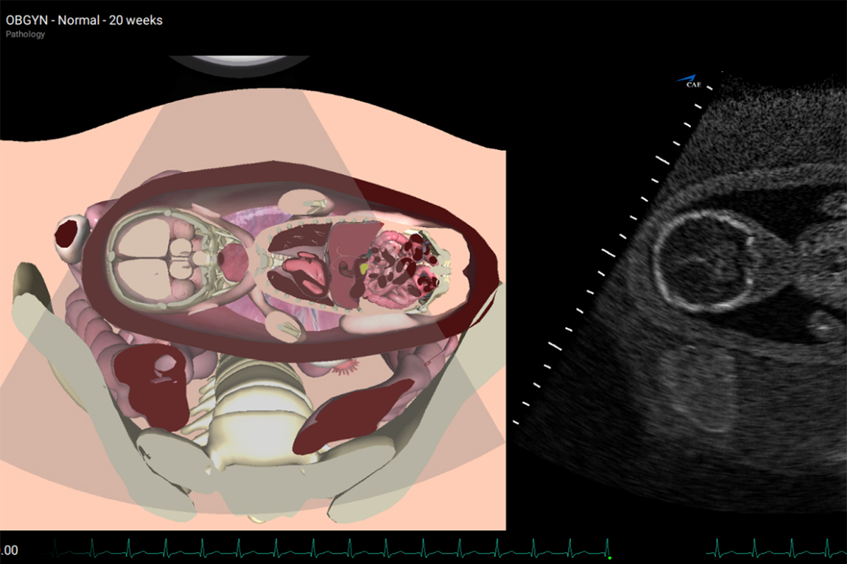Benefícios da simulação em ultrassom obstétrico e ginecológico Civiam