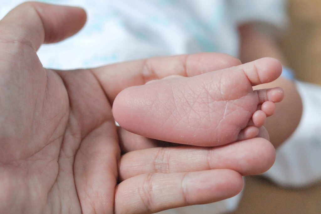 Foto da mão de um médico segurando o pé de um bebê