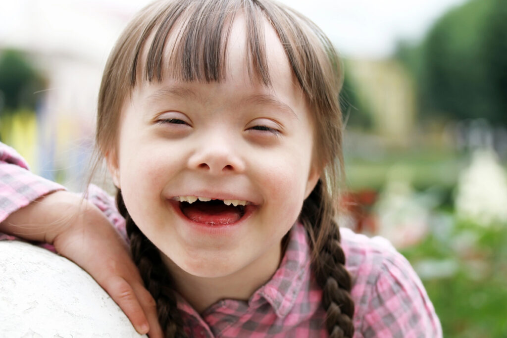 Foto de uma garotinha com deficiencia intelectual e múltipla sorrindo